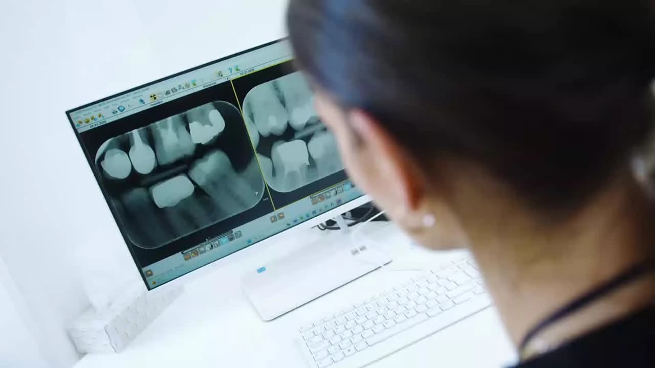 Lékařka plánuje protetickou práci podle rentgenových snímků