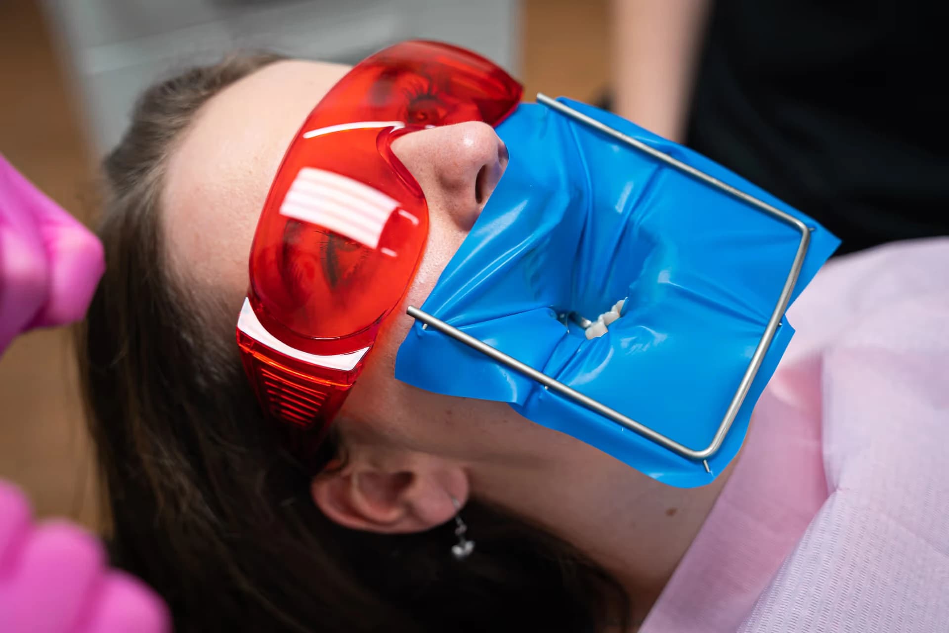 Ošetření pacientky s kofferdamem na klinice KissDent